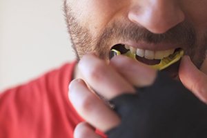 Patient inserting a mouthguard before enjoying sports