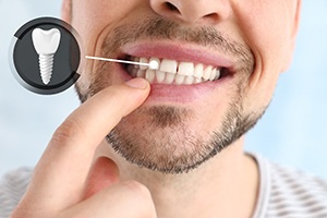 A man pointing out his implanted tooth against a light background